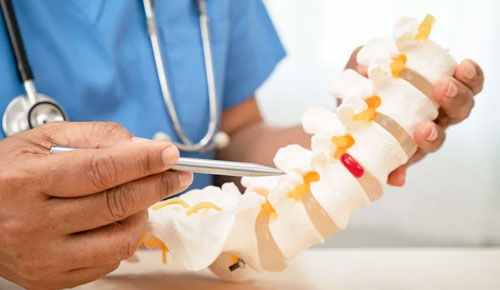 Back Pain or Slipped Disc