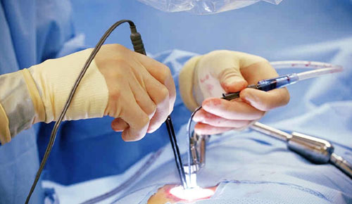 Minimally Invasive Spine Surgery