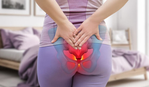 Coccydynia