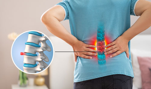 Slipped Disc