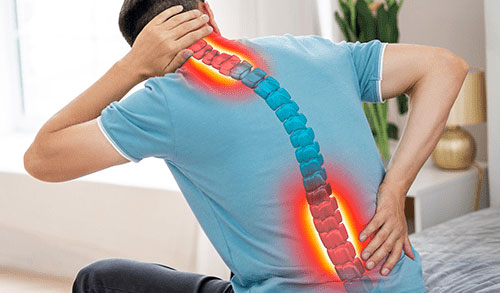 Spondylosis