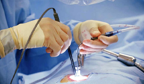 Minimally Invasive Spine Surgery