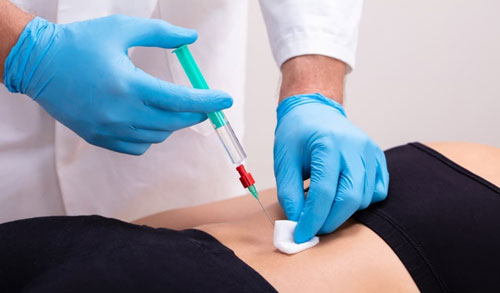 Spinal Injections